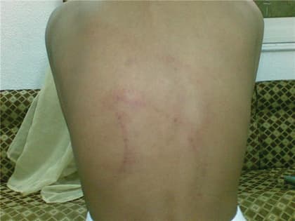 "تعليم المدينة" يحقق في دعوى ضرب طالب ابتدائي