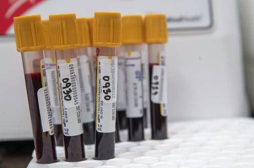 أخذ عينات الدم سلاح مهم لمكافحة وباء العصر