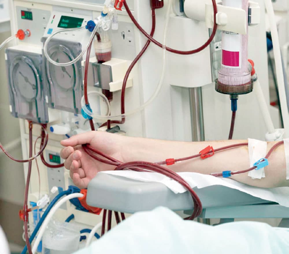 عدد مراكز الغسيل الكلوي 4 والوحدات 3 ."الاقتصادية"