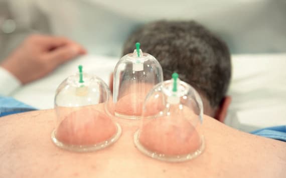 تعد مراكز الحجامة غير المرخصة بؤرة لانتشار الأمراض وقد تتسبب في الإصابة بـفيروس «سي».