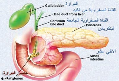 التهاب المرارة وأسبابه