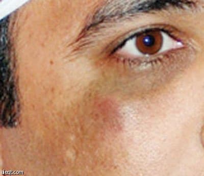 شمراني الشباب "يلكم" مراسل "الاقتصادية" في الرس