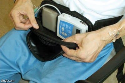 "التخصصي" يبدأ في استخدام عقار جديد لعلاج "الباركنسون"