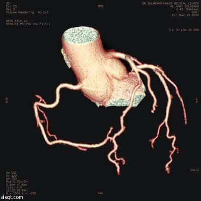 د. سعادة: جهاز CT-Scan الجديد يغني عن القسطرة التشخيصية ويقوم بتصوير شرايين القلب دون ألم أو تخدير