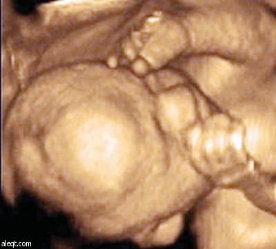 جهاز الـ 4D يعطي صورة مجسمة تساعد على تشخيص الأجنة قبل الولادة والاطمئنان عليهم