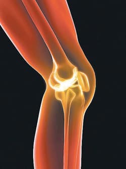 علاج آلام صابونة الركبة لدى الرياضيين يتم بطريقتين: التمارين أو إجراء الجراحات البسيطة