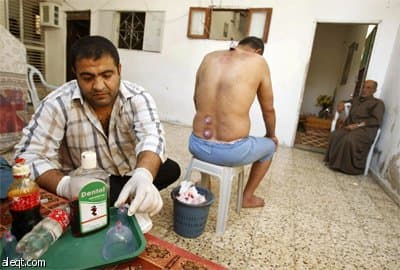 فلسطيني يجري "الحجامة" داخل عيادة في جنوب قطاع غزة.