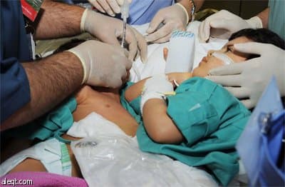 الربيعة يعلن نجاح فصل "عزيزة وسعيدة".. كل واحدة بسرير لأول مرة