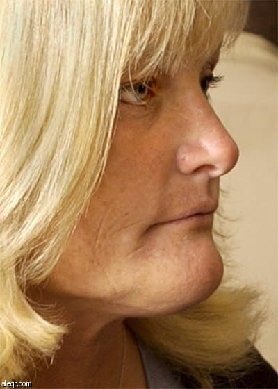 إعادة تشريح جثة مايكل جاكسون بناءا على طلب أسرته