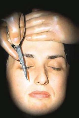 أمريكا: رواج الجراحات التجميلية رغم الأحزان الاقتصادية