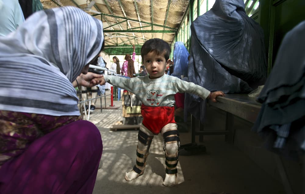فتاة أفغانية معاقة جسديا تنتظر لتتلقى العلاج  مع عدة أشخاص آخرين في مركز تقويم العظام في كابول.