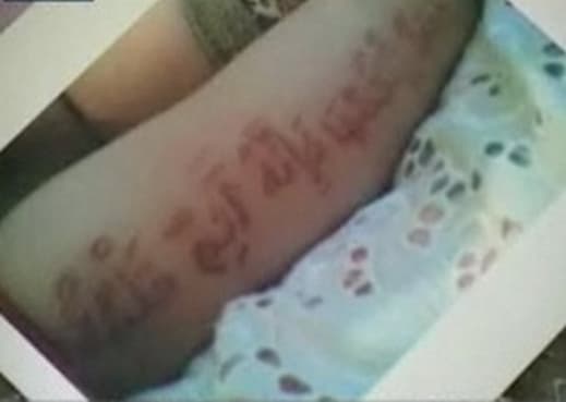 آيات وأحاديث تظهر وتختفي على جلد رضيع روسي في داغستان