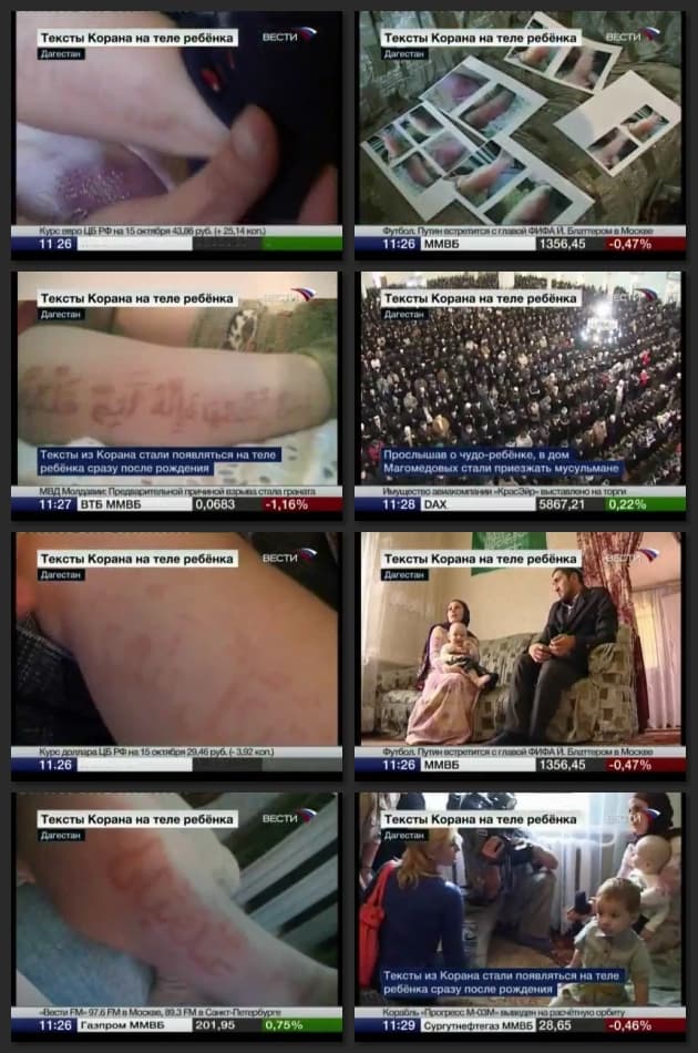 آيات وأحاديث تظهر وتختفي على جلد رضيع روسي في داغستان