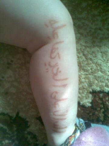 آيات وأحاديث تظهر وتختفي على جلد رضيع روسي في داغستان