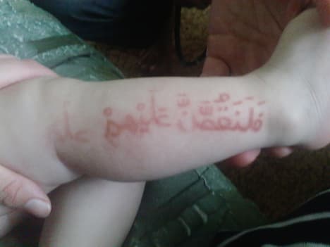 آيات وأحاديث تظهر وتختفي على جلد رضيع روسي في داغستان