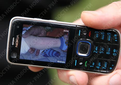 آيات وأحاديث تظهر وتختفي على جلد رضيع روسي في داغستان