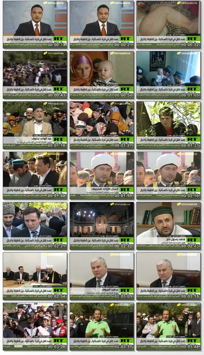 آيات وأحاديث تظهر وتختفي على جلد رضيع روسي في داغستان