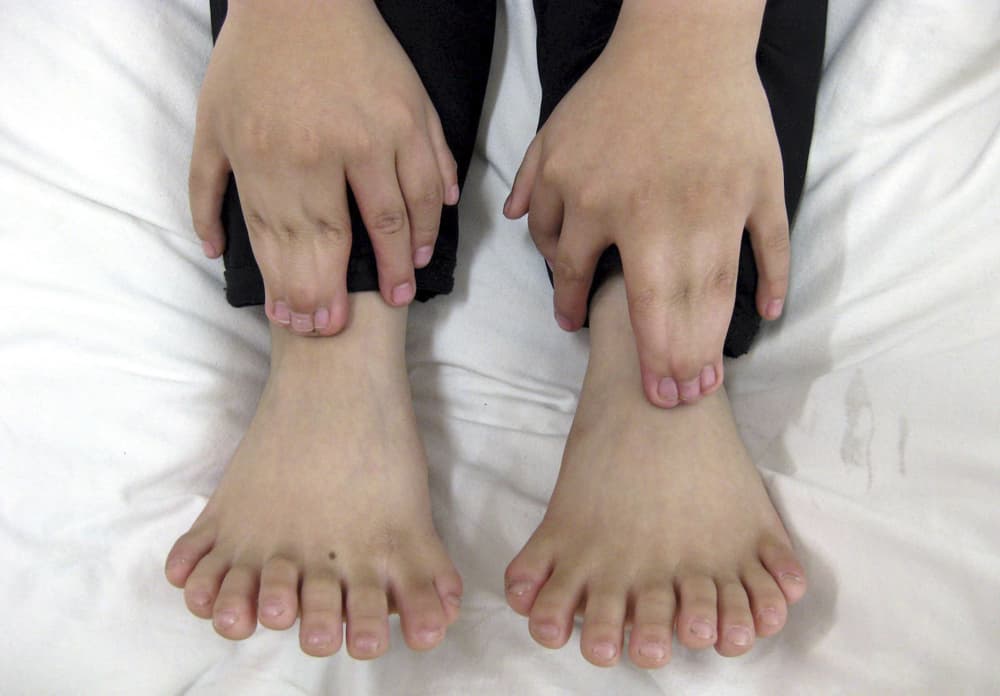 فتى صيني (6 أعوام) يظهر للإعلام أصابع يديه وقدميه -15 أصبع في اليد و 16 أصبع في القدم- داخل مستشفى شنيانغ الذي ستجرى بداخلة عملي