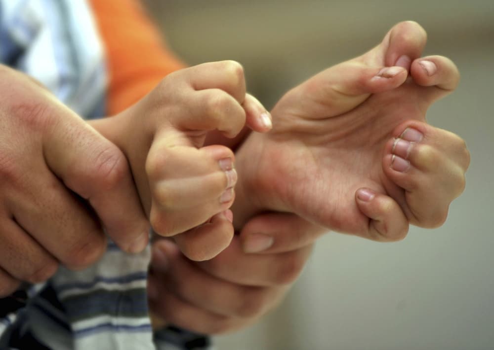 فتى صيني (6 أعوام) يظهر للإعلام أصابع يديه وقدميه -15 أصبع في اليد و 16 أصبع في القدم- داخل مستشفى شنيانغ الذي ستجرى بداخلة عملي