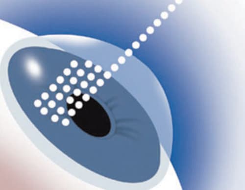 الأسرع لتتبع بصمة العين ومزود بخاصية المتابعة المزدوجة للقزحية والبؤبؤ