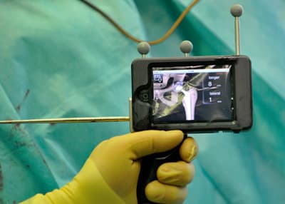 أطباء ألمان يستعينون بجهاز آي بود في إجراء عملية جراحية