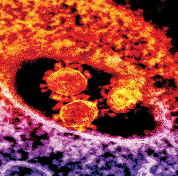 الصحة: لا توجد
حالات غير معلنة ..
لا تصدقوا الشائعات