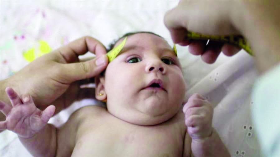 زيكا يهدد المواليد في أمريكا بعد ازدياد المصابين بعيوب خلقية