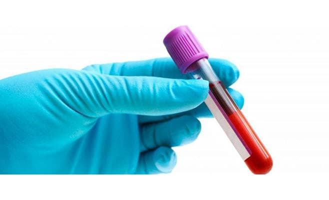 خبراء: لكل فصيلة دم حمية غذائية خاصة