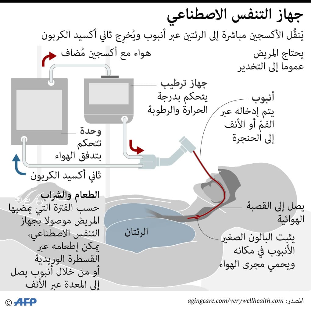 كيف يعمل جهاز التنفس الاصطناعي؟