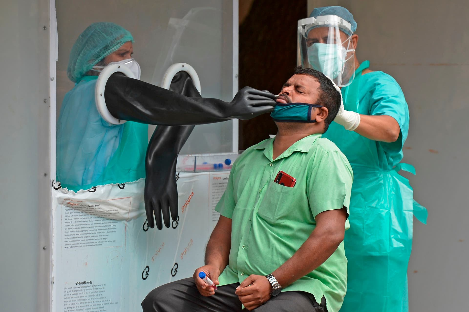 علماء يحذرون من موجة محتملة من الإصابات بتلف دماغي مرتبط بكورونا