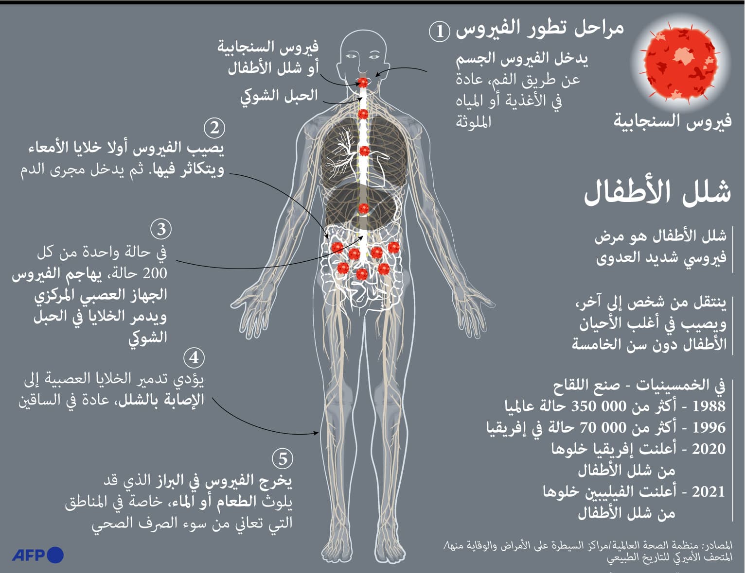 فيروس شلل الأطفال .. كيف يصيب الجسم؟