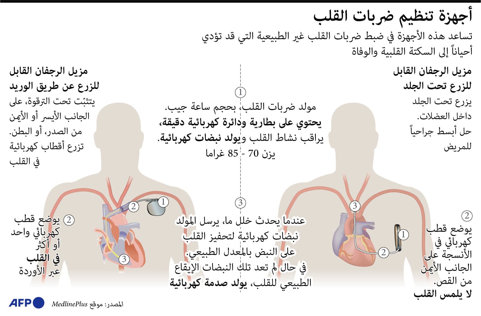 كيف تعمل أجهزة تنظيم ضربات القلب؟