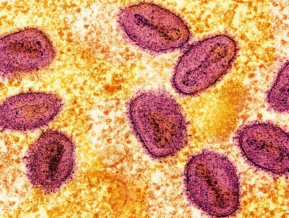 An undated colorized transmission electron micrograph of mpox virus particles (pink) found within an infected cell (yellow), cultured in the laboratory, captured at the National Institute of Allergy and Infectious Diseases (NIAID) Integrated Research Facility (IRF) in Fort Detrick, Maryland.  NIAID/Handout via REUTERS  THIS IMAGE HAS BEEN SUPPLIED BY A THIRD PARTY. MANDATORY CREDIT