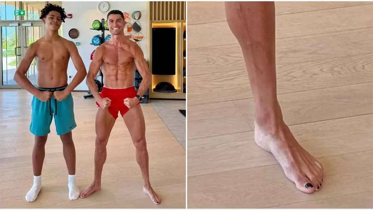 طلاء أظافر رونالدو إجراء وقائي ذو أساس طبي تكلفته 1000 ريال