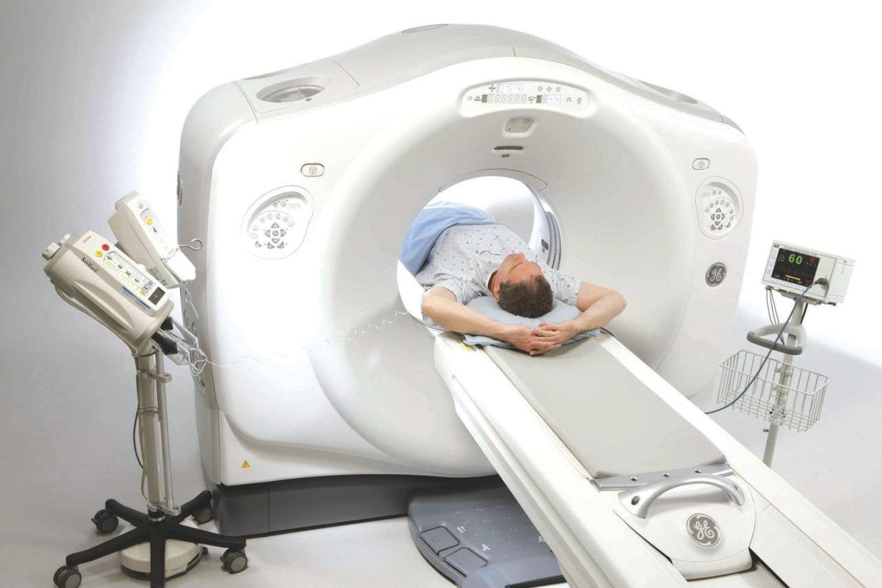 الأشعة المقطعية تحفز تطور سرطان الدماغ