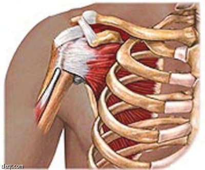 نسب نجاح عالية لأسلوبي التنظير والجراحة المفتوحة في علاج الخلع المتكرر للكتف