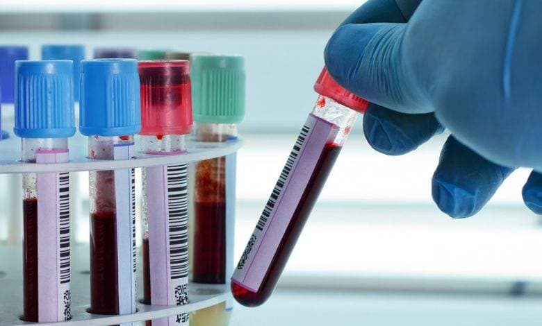 يؤدي التشخيص المبكر للسرطان إلى زيادة معدلات الشفاء بشكل كبير.