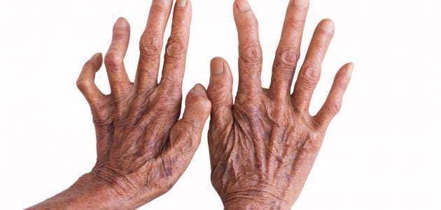 في مهب العشق