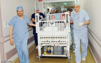 نجاح فصل السيامي العراقي «زينب ورقية» في مدينة الملك عبد العزيز الطبية