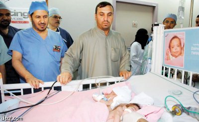 نجاح فصل السيامي العراقي «زينب ورقية» في مدينة الملك عبد العزيز الطبية