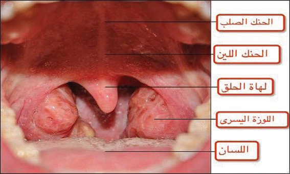 علاج التهاب اللوزتين.. الغرغرة بالمرامية والبابونج ومزيد من الدعم العاطفي