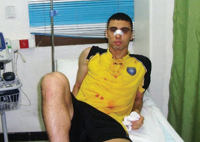 مميلي والحسين.. متعاركان بالكراسي