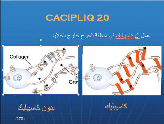 سعودي يتوصل لعلاج «تحلل الجلد الفقاعي» و«الغرغرينا» بالتكنولوجيا الطبيعية