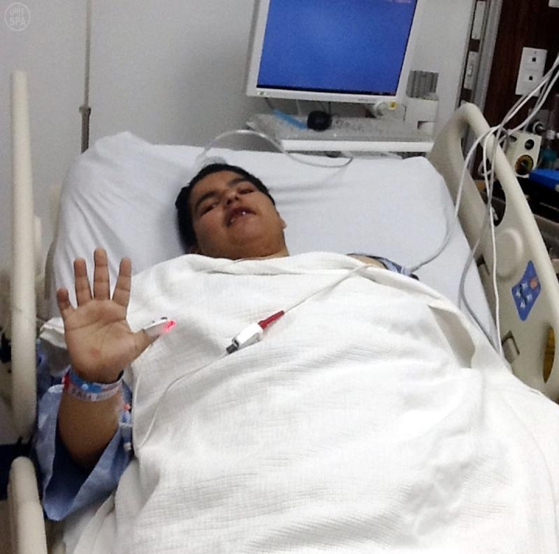 نجاح عملية مريض السمنة الشمري في مدينة الملك فهد الطبية