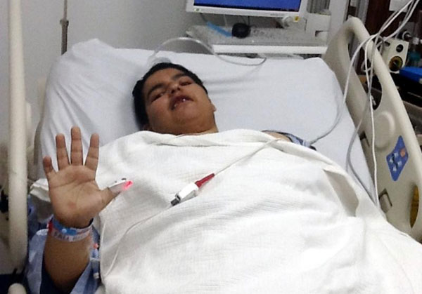 نجاح عملية مريض السمنة الشمري في مدينة الملك فهد الطبية