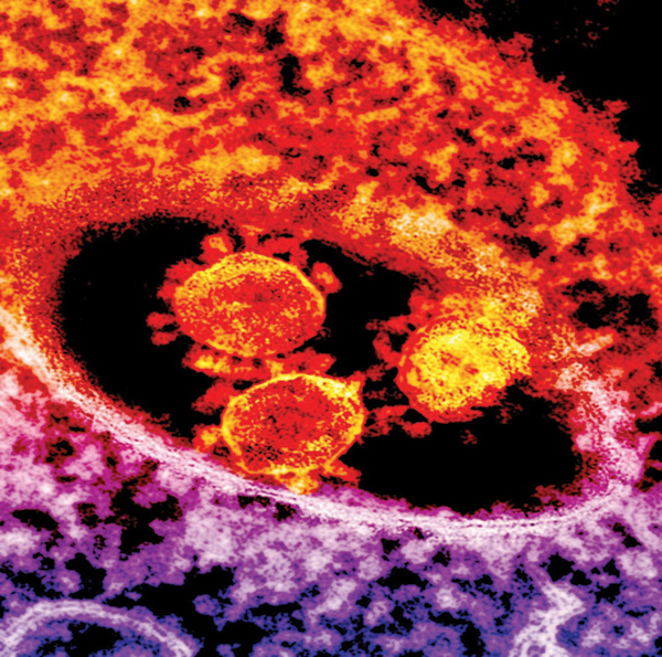 الصحة: لا توجد
حالات غير معلنة ..
لا تصدقوا الشائعات