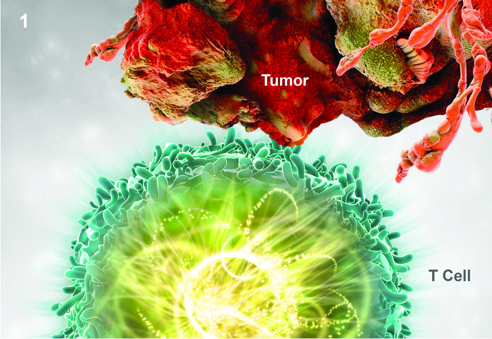 غلاء سعر عقار كيترودا يعرقل علاج السرطان