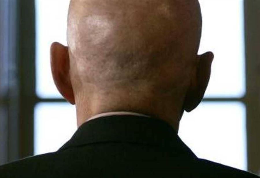 علاج رائد للصلع "ينهي" مأساة الرجال