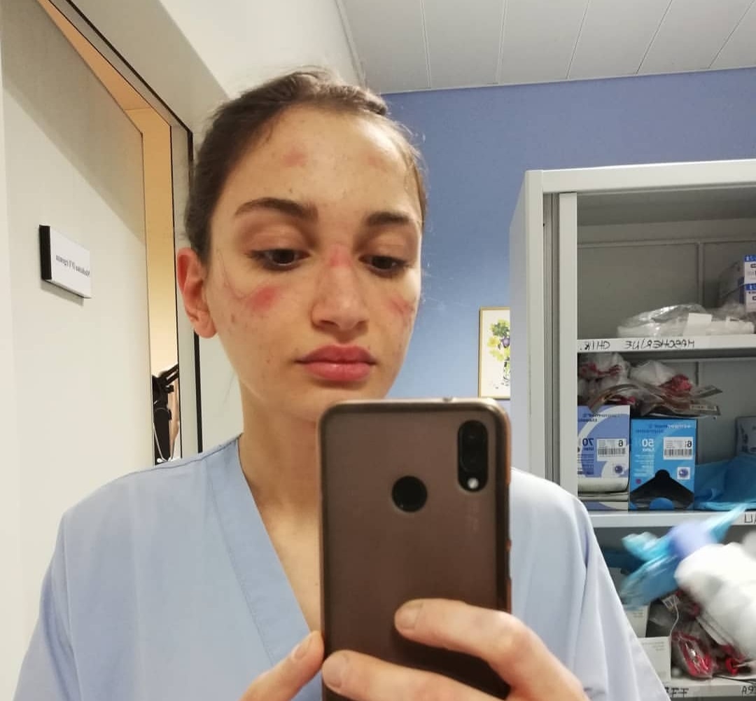 الإنهاك ينال من طواقم إيطاليا الطبية تحت ضغط العمل لمكافحة "كورونا" 