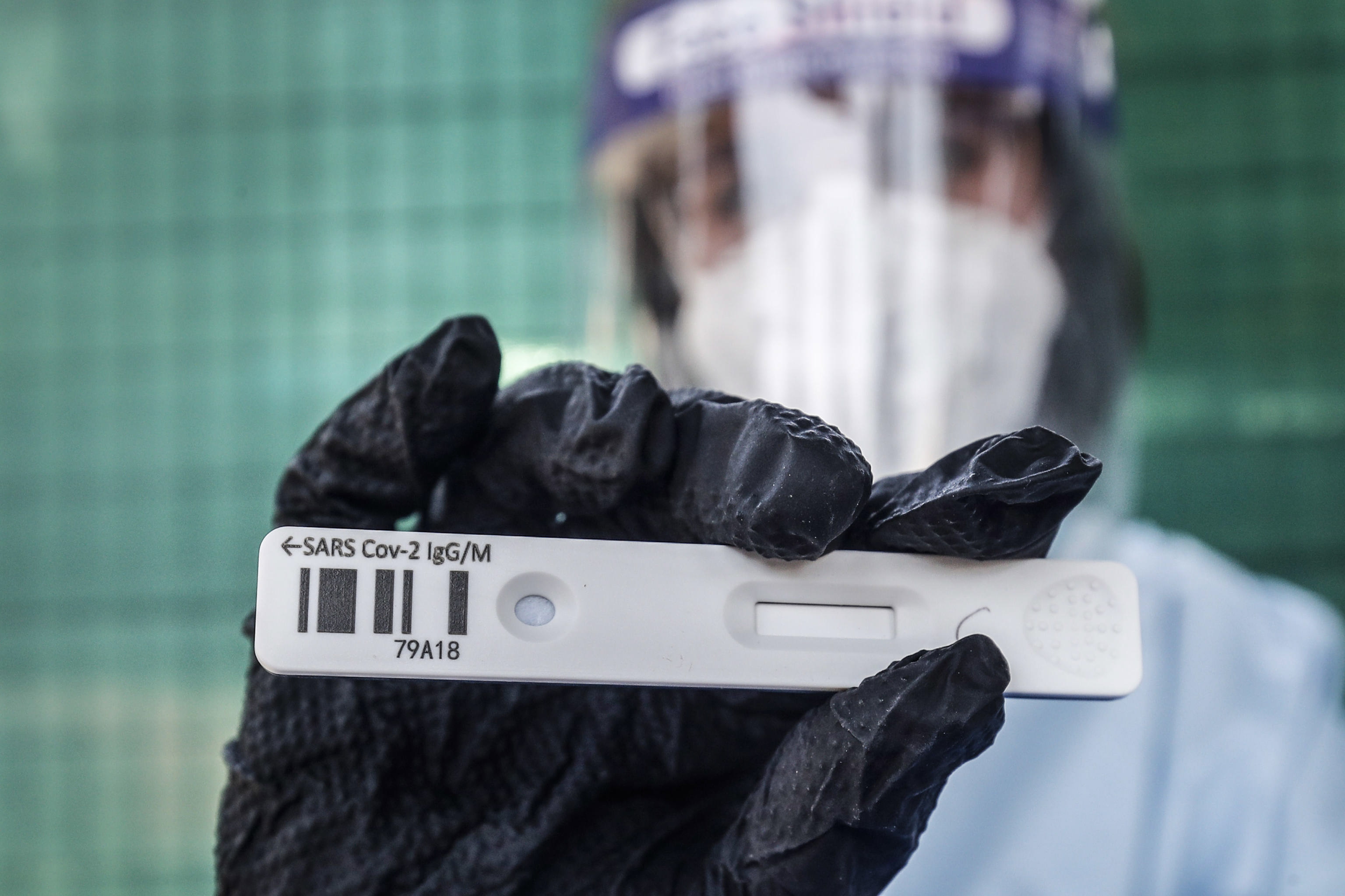 كيف يمكن أن يكون لدى بعض الأشخاص مناعة مسبقة ضد فيروس كورونا؟